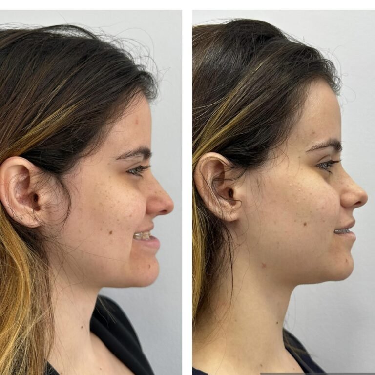 Instagram post from dr.lucasmarangon. This post is in position 9.