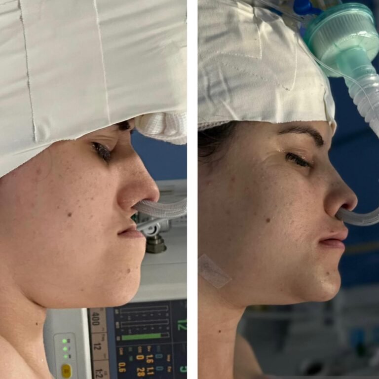 Instagram post from dr.lucasmarangon. This post is in position 13.