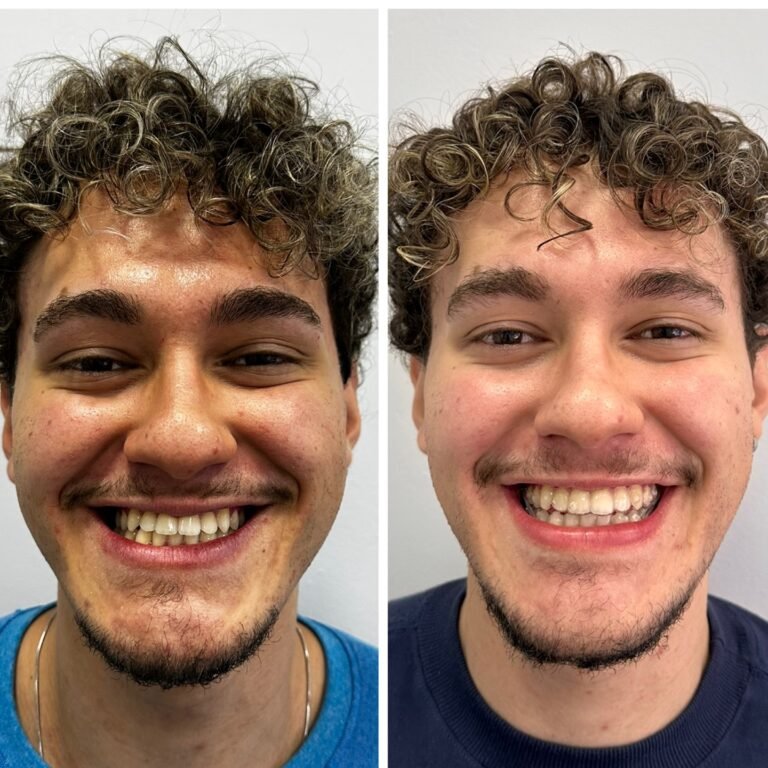 Instagram post from dr.lucasmarangon. This post is in position 2.