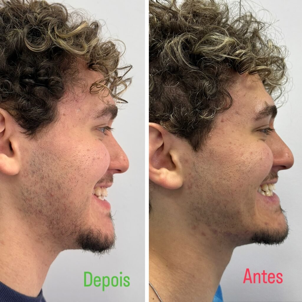 Instagram post from dr.lucasmarangon. This post is in position 2.