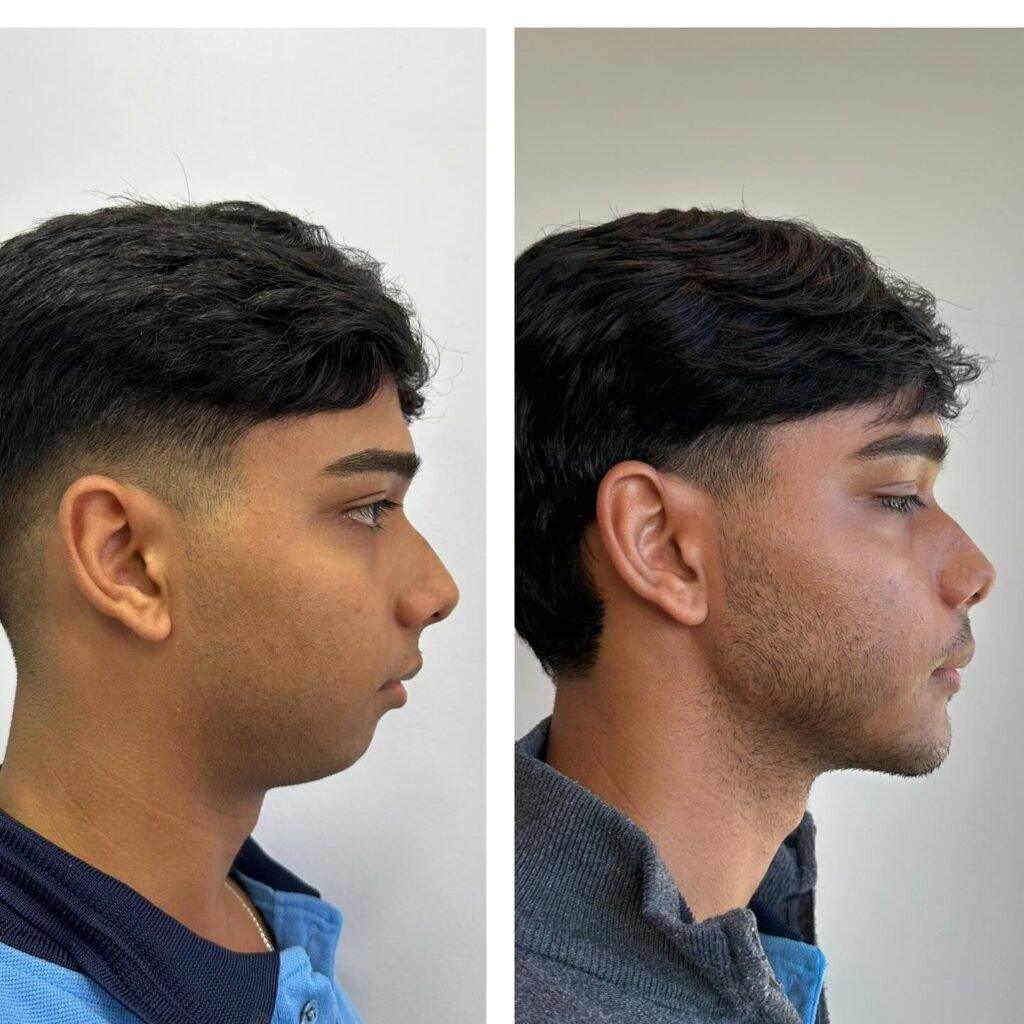 Instagram post from dr.lucasmarangon. This post is in position 10.