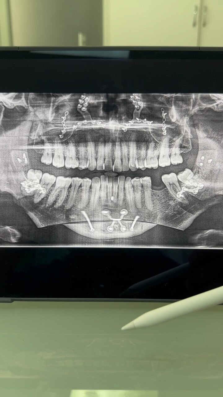 Instagram post from dr.lucasmarangon. This post is in position 15.