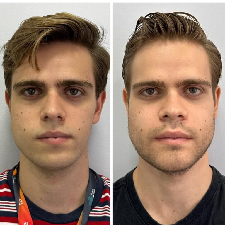 Instagram post from dr.lucasmarangon. This post is in position 6.