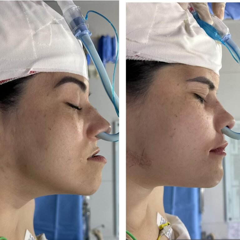 Instagram post from dr.lucasmarangon. This post is in position 12.